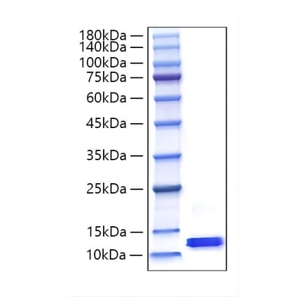 SDS-PAGE - Recombinant Mouse MCP-2 Protein (C-terminal His Tag) (A331501) - Antibodies.com