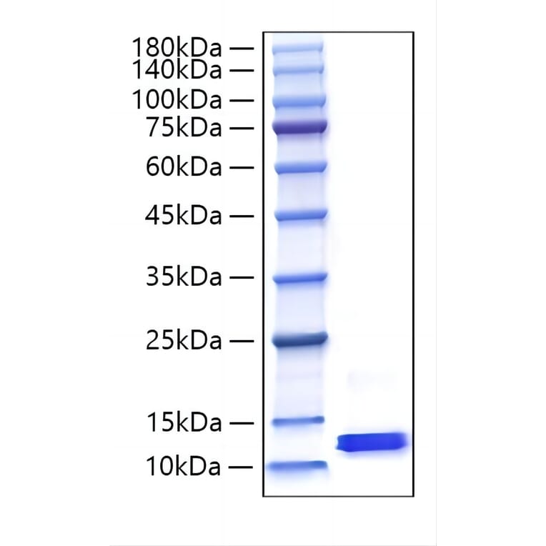 SDS-PAGE - Recombinant Mouse MCP-2 Protein (C-terminal His Tag) (A331501) - Antibodies.com
