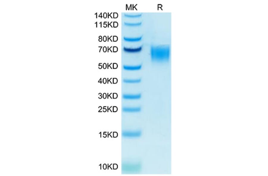 Tris-Bis PAGE - Recombinant Human CD200R Protein (Biotin) (C-terminal His and Avi Tag) (A331502) - Antibodies.com