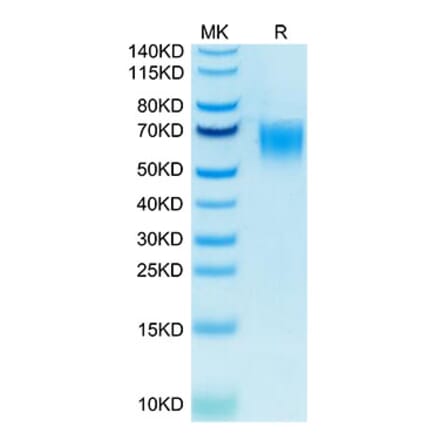 Tris-Bis PAGE - Recombinant Human CD200R Protein (Biotin) (C-terminal His and Avi Tag) (A331502) - Antibodies.com