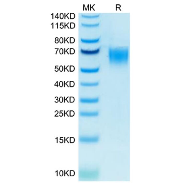 Tris-Bis PAGE - Recombinant Human CD200R Protein (Biotin) (C-terminal His and Avi Tag) (A331502) - Antibodies.com