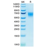 Tris-Bis PAGE - Recombinant Human CD200R Protein (Biotin) (C-terminal His and Avi Tag) (A331502) - Antibodies.com