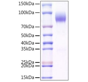 SDS-PAGE - Recombinant Mouse CD200R Protein (C-terminal Human Fc and Avi Tag) (A331503) - Antibodies.com