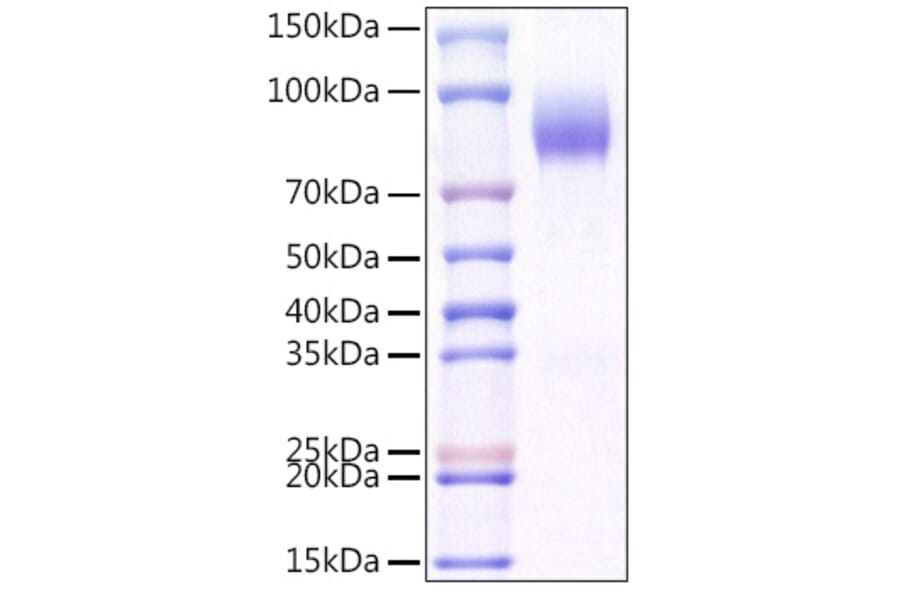 SDS-PAGE - Recombinant Mouse CD200R Protein (C-terminal Human Fc and Avi Tag) (A331503) - Antibodies.com