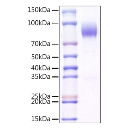 SDS-PAGE - Recombinant Mouse CD200R Protein (C-terminal Human Fc and Avi Tag) (A331503) - Antibodies.com