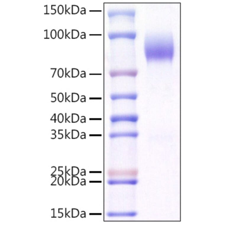 SDS-PAGE - Recombinant Mouse CD200R Protein (C-terminal Human Fc and Avi Tag) (A331503) - Antibodies.com