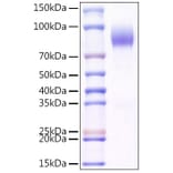 SDS-PAGE - Recombinant Mouse CD200R Protein (C-terminal Human Fc and Avi Tag) (A331503) - Antibodies.com