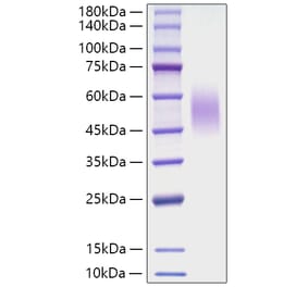 SDS-PAGE - Recombinant Mouse CD200R Protein (C-terminal His Tag) (A331504) - Antibodies.com