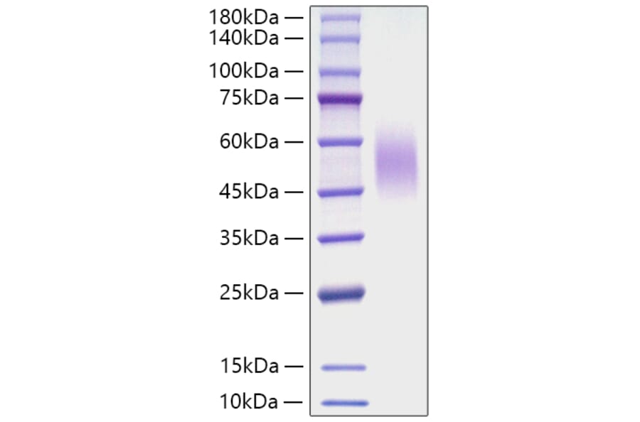 SDS-PAGE - Recombinant Mouse CD200R Protein (C-terminal His Tag) (A331504) - Antibodies.com