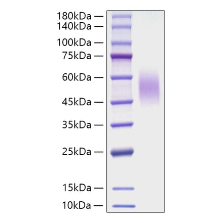 SDS-PAGE - Recombinant Mouse CD200R Protein (C-terminal His Tag) (A331504) - Antibodies.com
