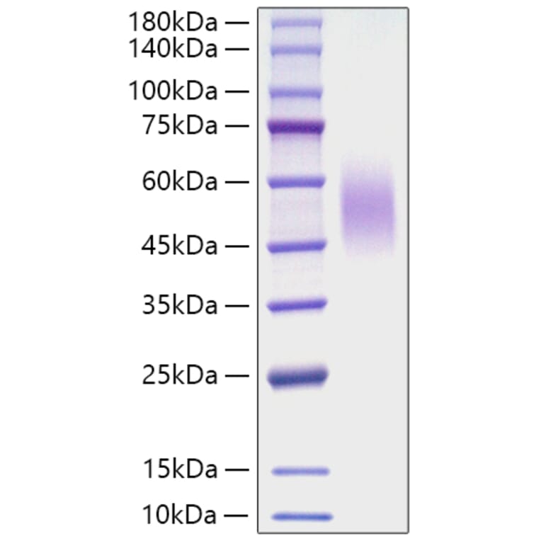 SDS-PAGE - Recombinant Mouse CD200R Protein (C-terminal His Tag) (A331504) - Antibodies.com