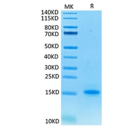 Tris-Bis PAGE - Recombinant Cynomolgus macaque CD3 epsilon Protein (C-terminal His Tag) (A331505) - Antibodies.com