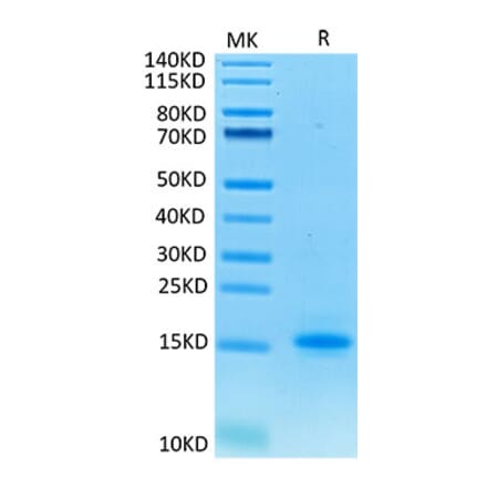 Tris-Bis PAGE - Recombinant Cynomolgus macaque CD3 epsilon Protein (C-terminal His Tag) (A331505) - Antibodies.com