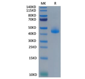 Tris-Bis PAGE - Recombinant Cynomolgus macaque CD3 epsilon Protein (C-terminal Human Fc Tag) (A331506) - Antibodies.com