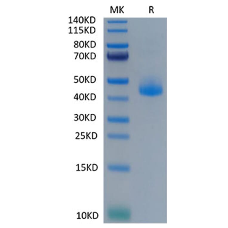 Tris-Bis PAGE - Recombinant Cynomolgus macaque CD3 epsilon Protein (C-terminal Human Fc Tag) (A331506) - Antibodies.com