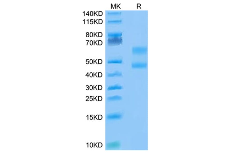 Tris-Bis PAGE - Recombinant Cynomolgus macaque CD3E + CD3D Protein (Biotin) (C-terminal Human Fc Tag) (A331509) - Antibodies.com