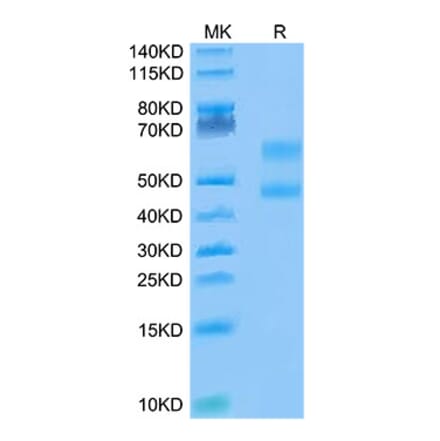Tris-Bis PAGE - Recombinant Cynomolgus macaque CD3E + CD3D Protein (Biotin) (C-terminal Human Fc Tag) (A331509) - Antibodies.com