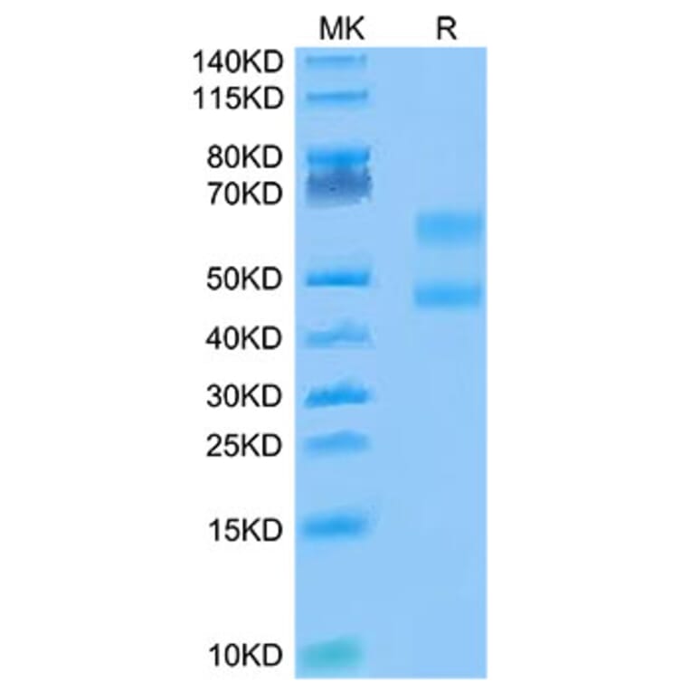 Tris-Bis PAGE - Recombinant Cynomolgus macaque CD3E + CD3D Protein (Biotin) (C-terminal Human Fc Tag) (A331509) - Antibodies.com