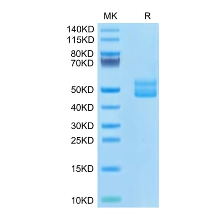 Tris-Bis PAGE - Recombinant Human CD3E + CD3G Protein (C-terminal Human Fc Tag) (A331511) - Antibodies.com