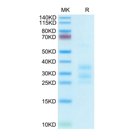 Tris-Bis PAGE - Recombinant Human CD3E + CD3G Protein (C-terminal His Tag) (A331512) - Antibodies.com