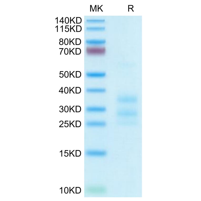 Tris-Bis PAGE - Recombinant Human CD3E + CD3G Protein (C-terminal His Tag) (A331512) - Antibodies.com
