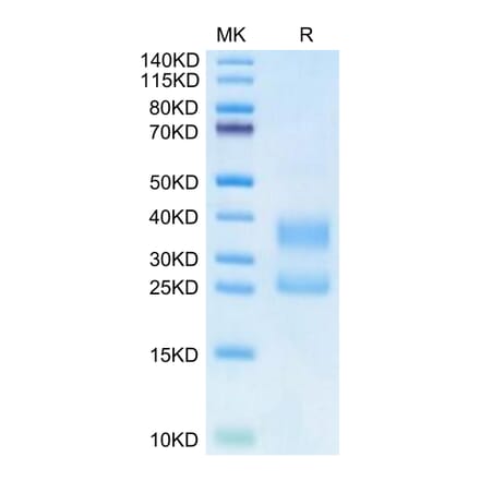 Tris-Bis PAGE - Recombinant Human CD3E + CD3G Protein (Biotin) (C-terminal His Tag) (A331514) - Antibodies.com