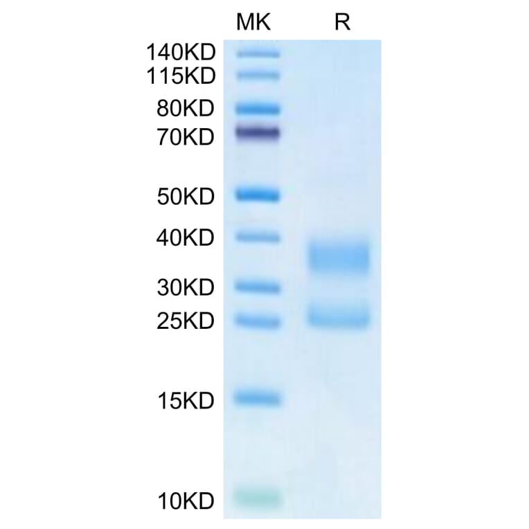 Tris-Bis PAGE - Recombinant Human CD3E + CD3G Protein (Biotin) (C-terminal His Tag) (A331514) - Antibodies.com