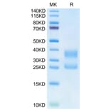 Tris-Bis PAGE - Recombinant Human CD3E + CD3G Protein (Biotin) (C-terminal His Tag) (A331514) - Antibodies.com