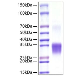 SDS-PAGE - Recombinant Mouse CD8 alpha Protein (C-terminal His Tag) (A331515) - Antibodies.com