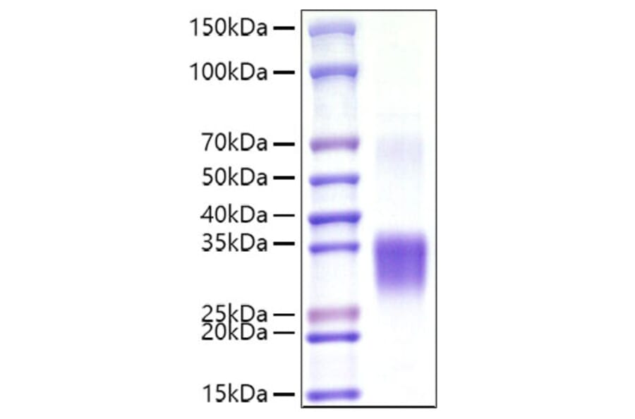 SDS-PAGE - Recombinant Mouse CD8 alpha Protein (C-terminal His Tag) (A331515) - Antibodies.com