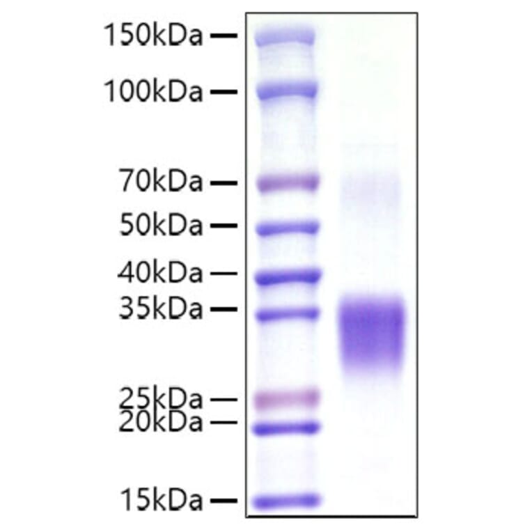 SDS-PAGE - Recombinant Mouse CD8 alpha Protein (C-terminal His Tag) (A331515) - Antibodies.com