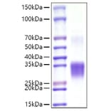 SDS-PAGE - Recombinant Mouse CD8 alpha Protein (C-terminal His Tag) (A331515) - Antibodies.com