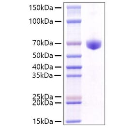 SDS-PAGE - Recombinant Mouse CD8 alpha Protein (C-terminal Human Fc Tag) (A331516) - Antibodies.com