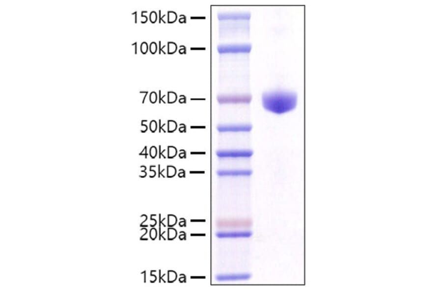 SDS-PAGE - Recombinant Mouse CD8 alpha Protein (C-terminal Human Fc Tag) (A331516) - Antibodies.com
