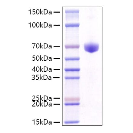 SDS-PAGE - Recombinant Mouse CD8 alpha Protein (C-terminal Human Fc Tag) (A331516) - Antibodies.com