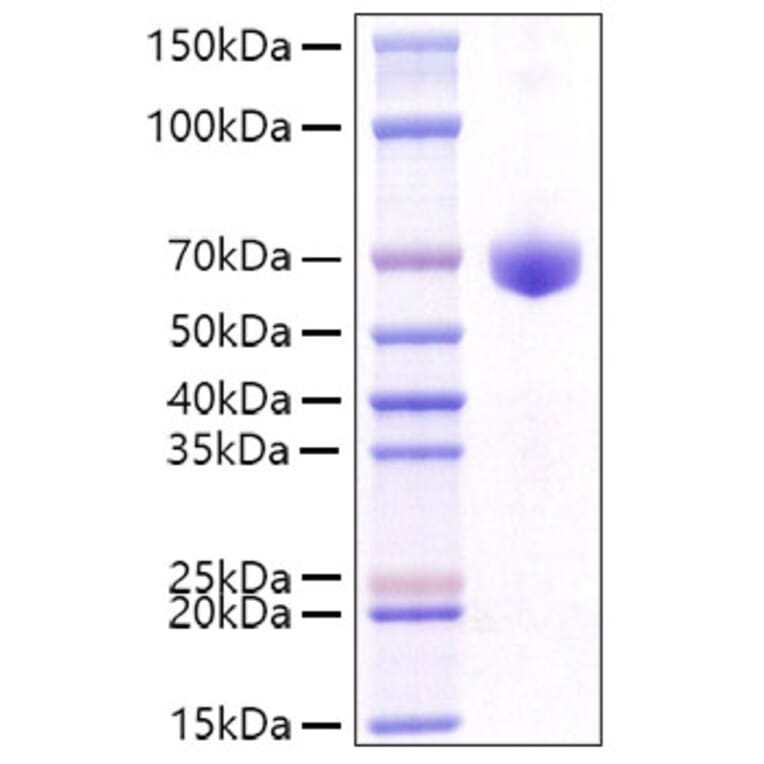 SDS-PAGE - Recombinant Mouse CD8 alpha Protein (C-terminal Human Fc Tag) (A331516) - Antibodies.com