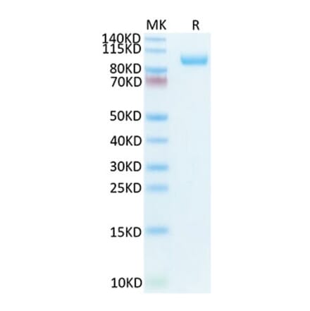 Tris-Bis PAGE - Recombinant Mouse CDCP1 Protein (Biotin) (C-terminal His and Avi Tag) (A331517) - Antibodies.com