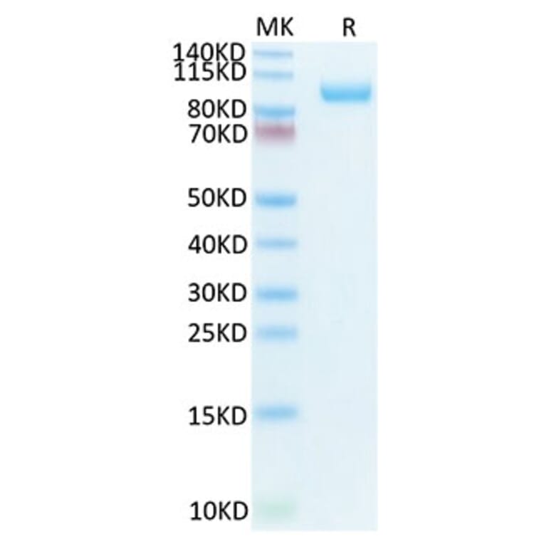 Tris-Bis PAGE - Recombinant Mouse CDCP1 Protein (Biotin) (C-terminal His and Avi Tag) (A331517) - Antibodies.com