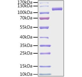 SDS-PAGE - Recombinant Mouse CDCP1 Protein (C-terminal His and Avi Tag) (A331518) - Antibodies.com