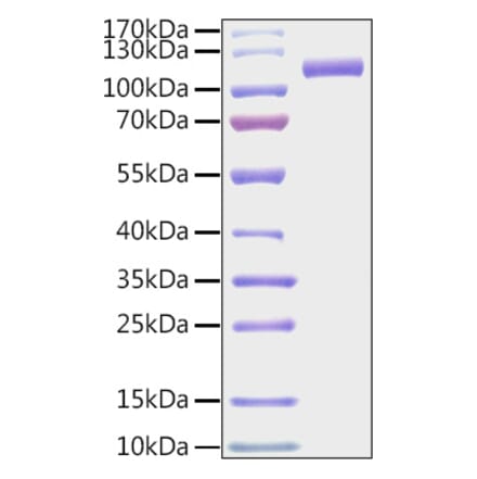 SDS-PAGE - Recombinant Mouse CDCP1 Protein (C-terminal His and Avi Tag) (A331518) - Antibodies.com
