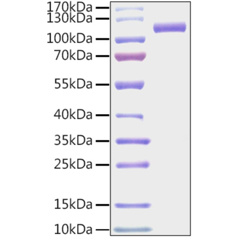 SDS-PAGE - Recombinant Mouse CDCP1 Protein (C-terminal His and Avi Tag) (A331518) - Antibodies.com
