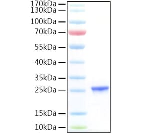 SDS-PAGE - Recombinant Human CGB7 Protein (C-terminal His Tag) (A331519) - Antibodies.com