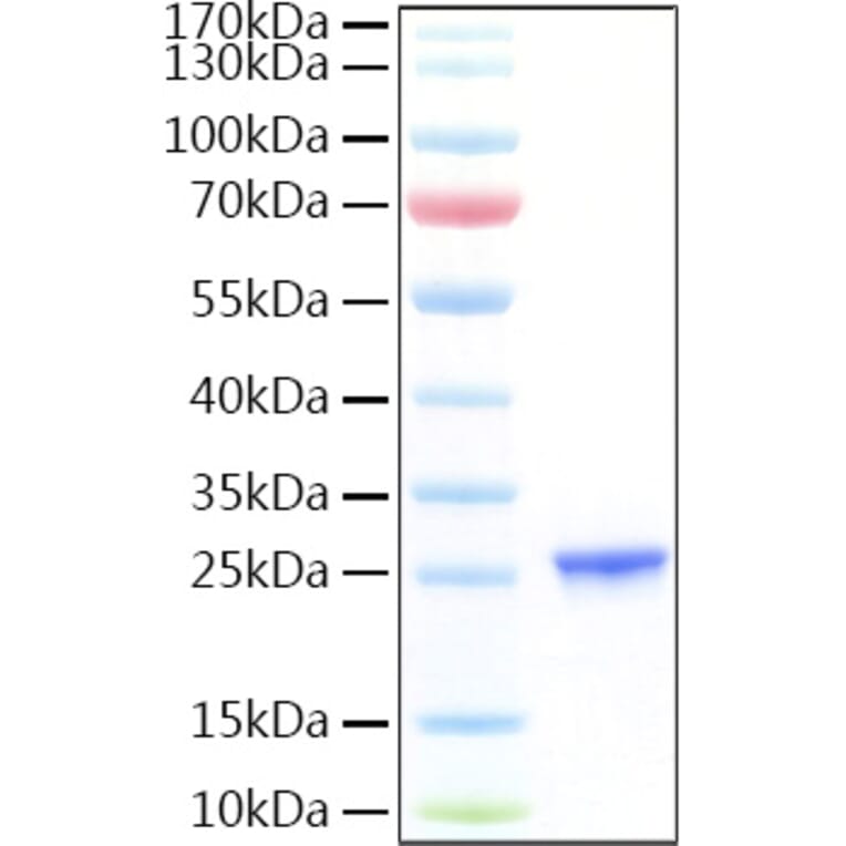 SDS-PAGE - Recombinant Human CGB7 Protein (C-terminal His Tag) (A331519) - Antibodies.com