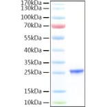 SDS-PAGE - Recombinant Human CGB7 Protein (C-terminal His Tag) (A331519) - Antibodies.com