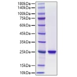 SDS-PAGE - Recombinant Human CSH1 Protein (C-terminal His Tag) (A331520) - Antibodies.com