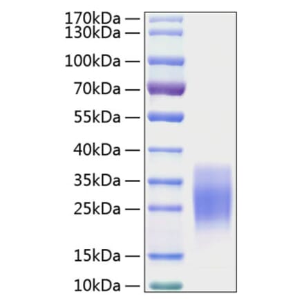 SDS-PAGE - Recombinant Mouse SCF Protein (C-terminal His Tag) (A331521) - Antibodies.com