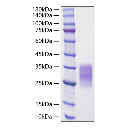 SDS-PAGE - Recombinant Rat SCF Protein (C-terminal His Tag) (A331522) - Antibodies.com