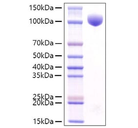 SDS-PAGE - Recombinant Mouse c-Kit Protein (C-terminal Rabbit Fc Tag) (A331523) - Antibodies.com