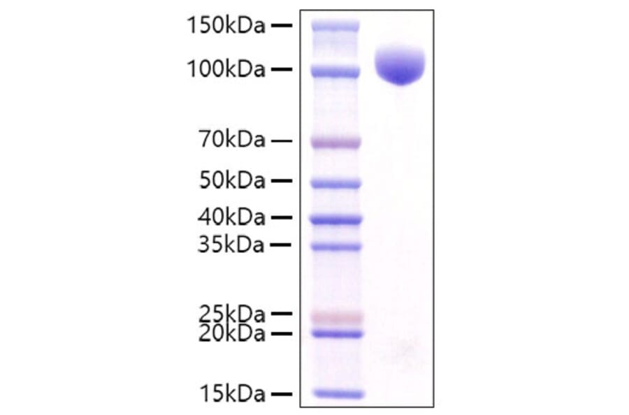 SDS-PAGE - Recombinant Mouse c-Kit Protein (C-terminal Rabbit Fc Tag) (A331523) - Antibodies.com