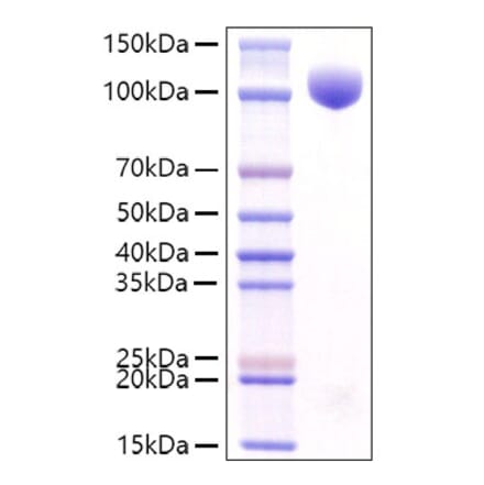 SDS-PAGE - Recombinant Mouse c-Kit Protein (C-terminal Rabbit Fc Tag) (A331523) - Antibodies.com